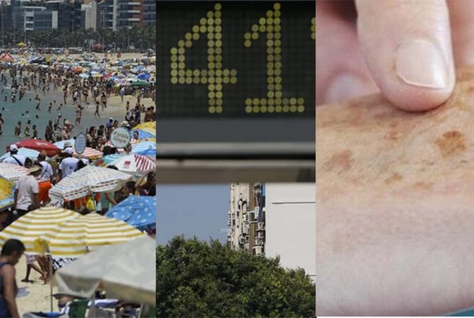 Verano, playa y sol fuerte. ¡Aprende cómo protegerte del cáncer de piel!